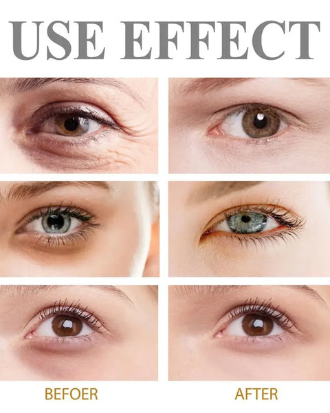 BrightEyes™ -  Eye Firming Gel