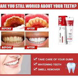 🔥 2023 YEAR END SALE 🔥YAYASHI™ - SP-4 ToothPaste - TumTum