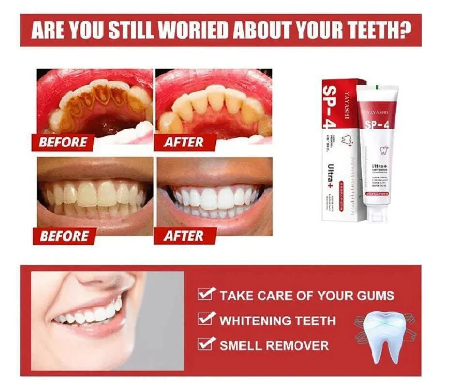 🔥 2023 YEAR END SALE 🔥YAYASHI™ - SP-4 ToothPaste - TumTum