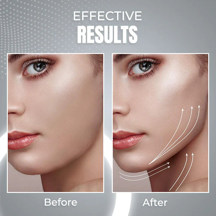 AntiChin™ - 2 in 1 Anti Snoring and Anti-Aging Facial Contouring Device (50% off)