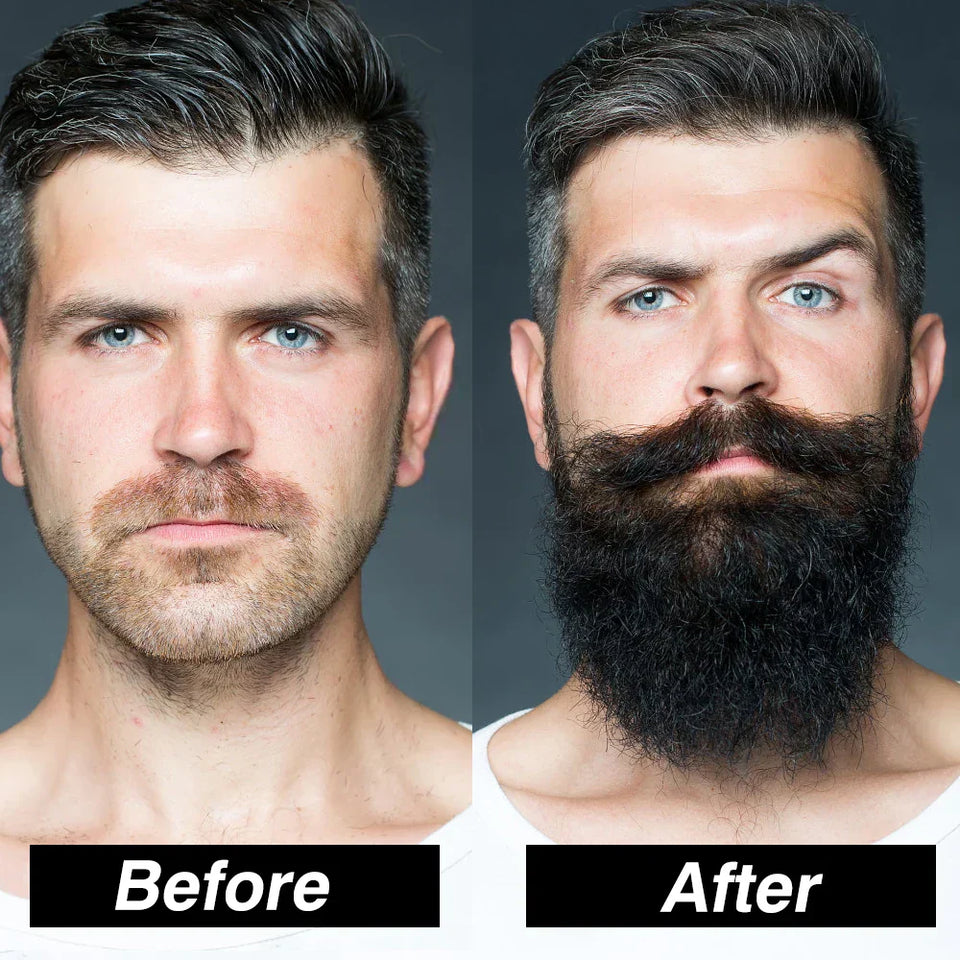 BeardBoost™