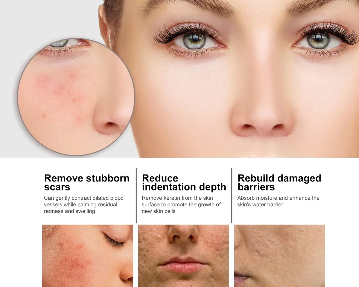🔥Last Day Promotion 64% OFF-Niacinamide Facial Essence💖