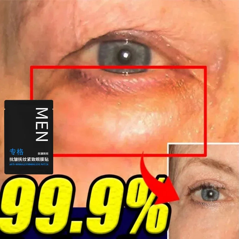 RadiantEyes™ - Eye Bags Removal Patch
