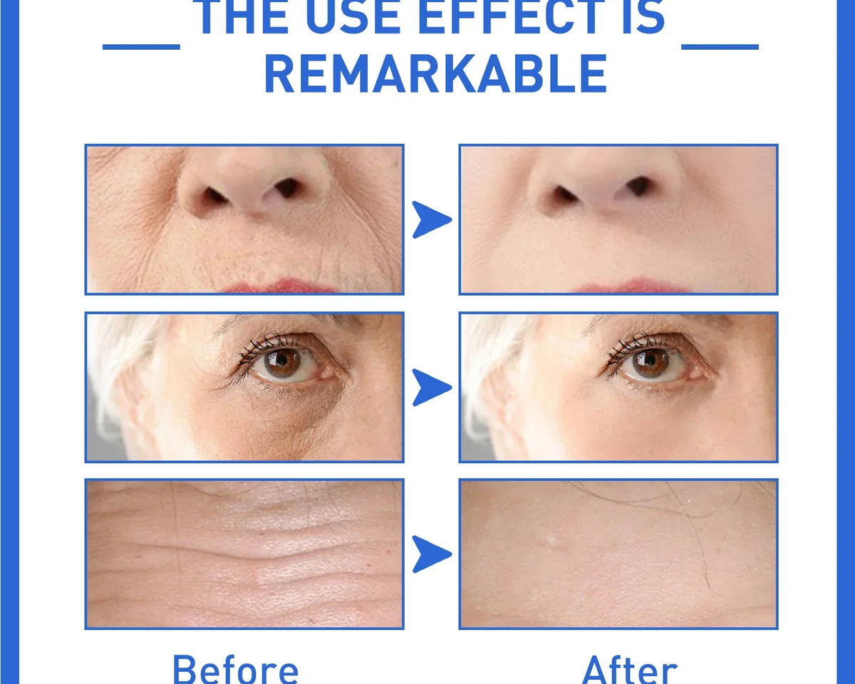 AgeLift™ - Anti-Age Serum