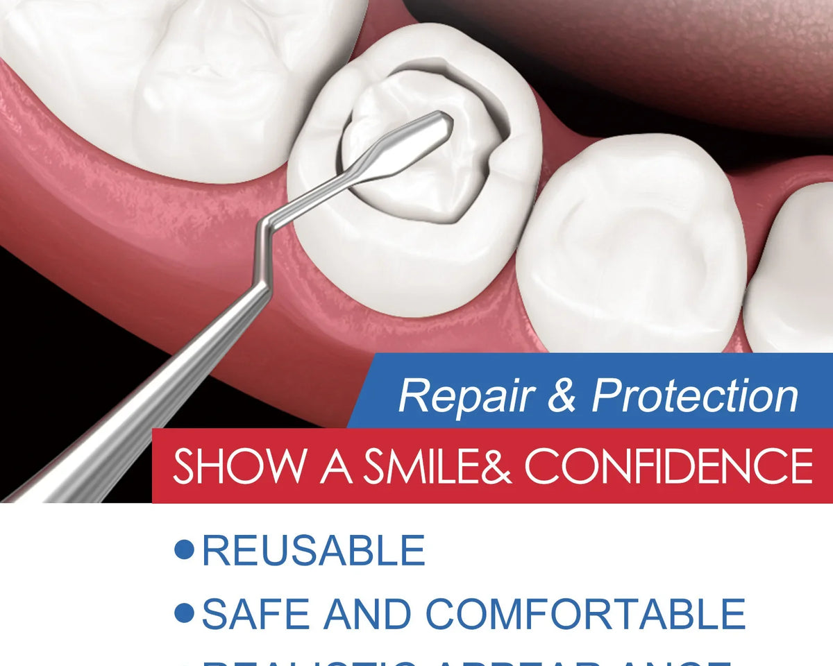 DentFix™ - Temporary Tooth Repair Kit