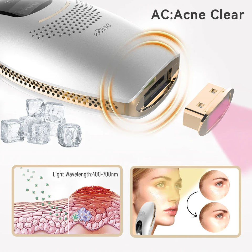 EpiLuxe™ - Hair Removal Machine