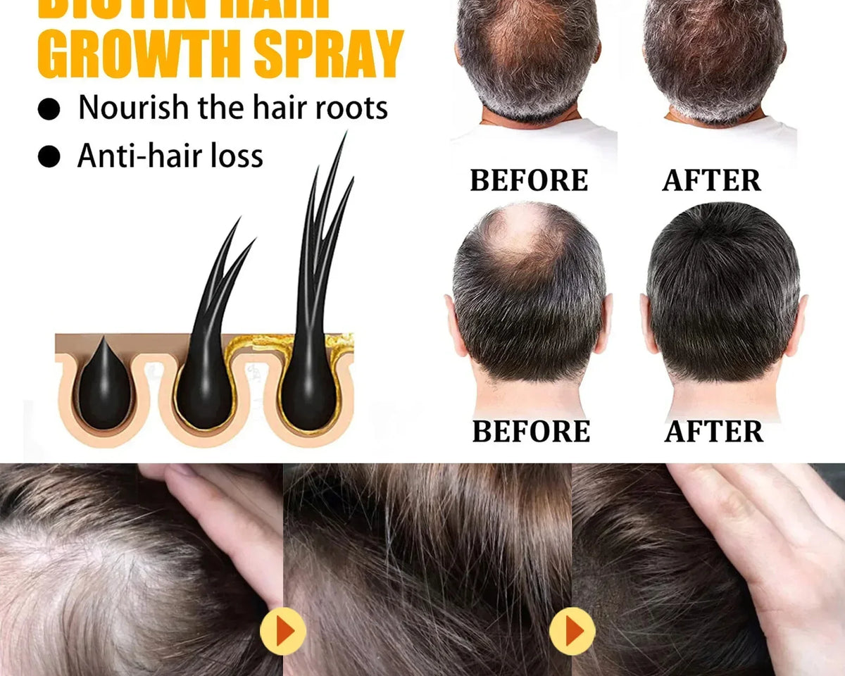 🔥(LAST DAY SALE-80% OFF) Moonbiffy™ Biotin Premium Hair Growth Serum