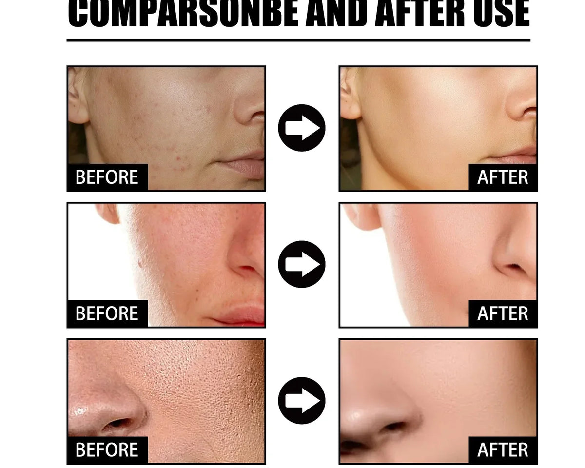 🔥Last Day Promotion 64% OFF-Niacinamide Facial Essence💖
