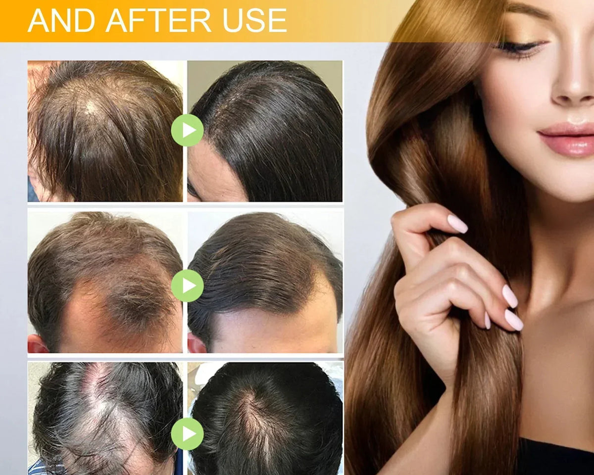 🔥(LAST DAY SALE-80% OFF) Moonbiffy™ Biotin Premium Hair Growth Serum
