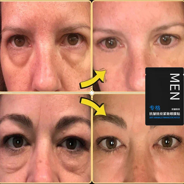 RadiantEyes™ - Eye Bags Removal Patch