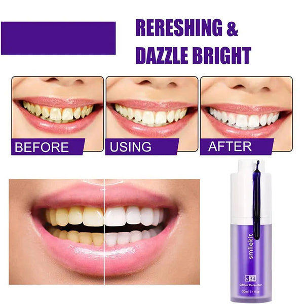 SmileBrite™ - Teeth Whitening Kit