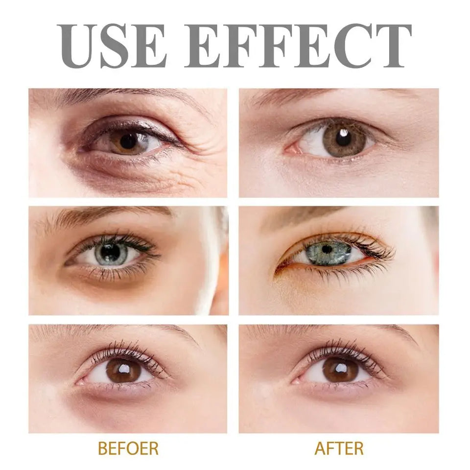 BrightEyes™ -  Eye Firming Gel