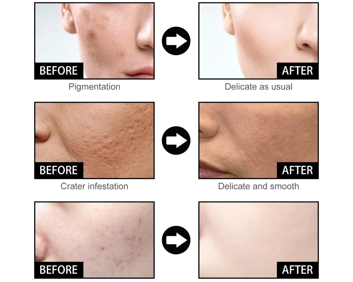 🔥Last Day Promotion 64% OFF-Niacinamide Facial Essence💖