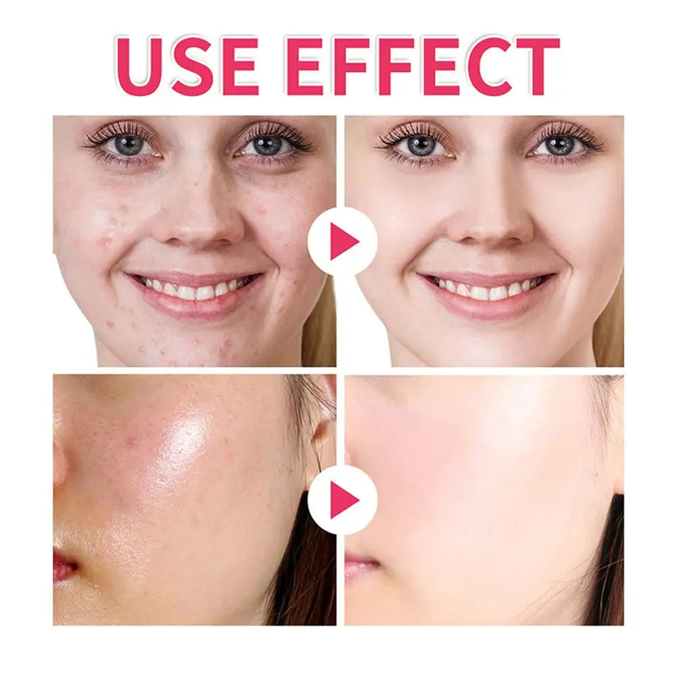 GlowBright ™ - Turmeric Pads