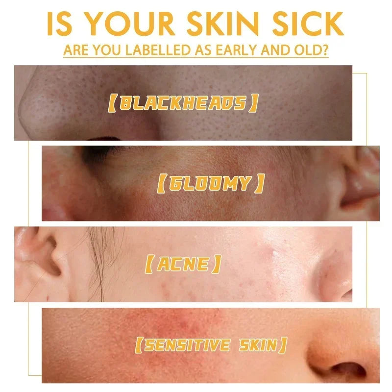 The Viral FreshFace™ - Honey Tearing Mask