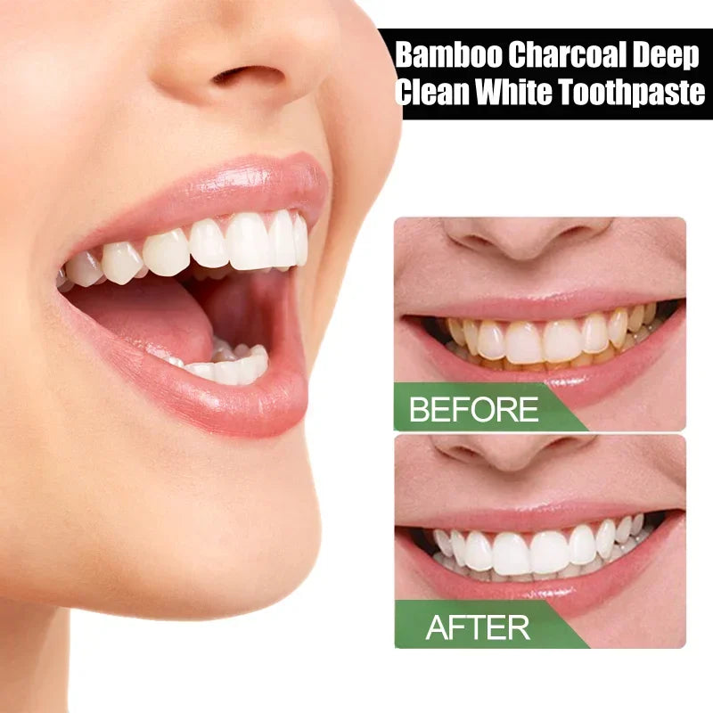 SparkleFresh™ - Bamboo Charcoal Whitening Toothpaste