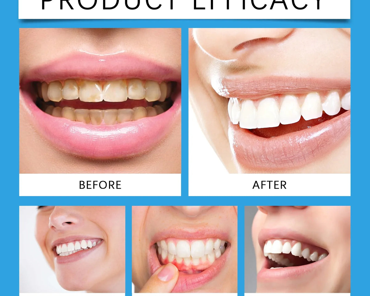 WhiteSimple™ - Teeth Whitening Powder