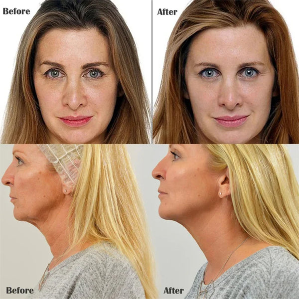 COLLAGEN THREAD WITH 24K GOLD SERUM