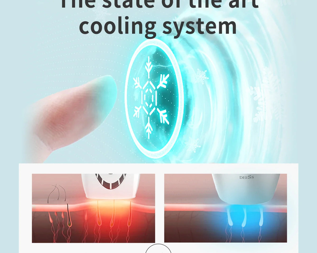 EpiLuxe™ - Hair Removal Machine