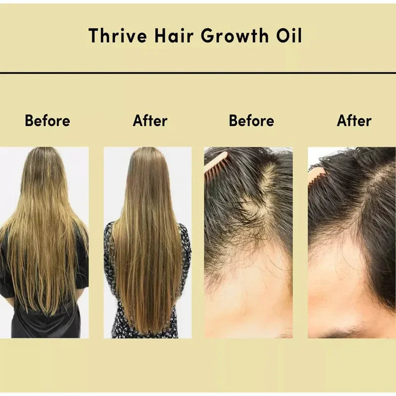 ✨Bobbasow ™ Natural Hair Growth Oil