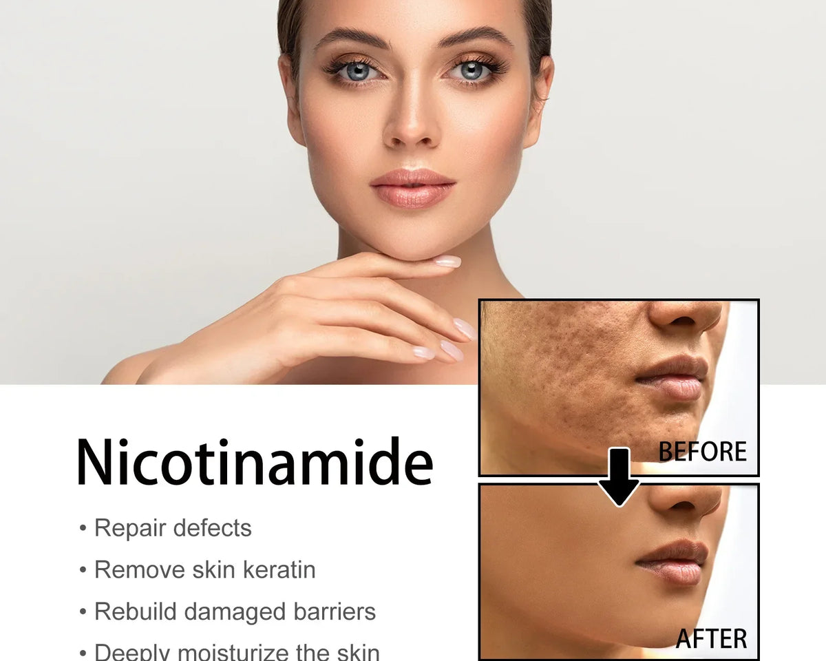 🔥Last Day Promotion 64% OFF-Niacinamide Facial Essence💖