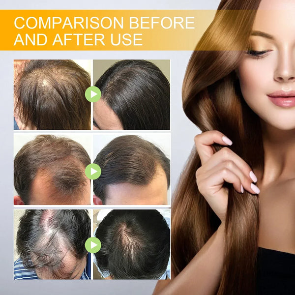 🔥(LAST DAY SALE-80% OFF) Moonbiffy™ Biotin Premium Hair Growth Serum