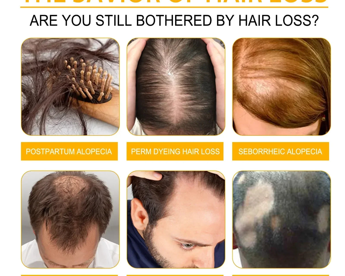 🔥(LAST DAY SALE-80% OFF) Moonbiffy™ Biotin Premium Hair Growth Serum