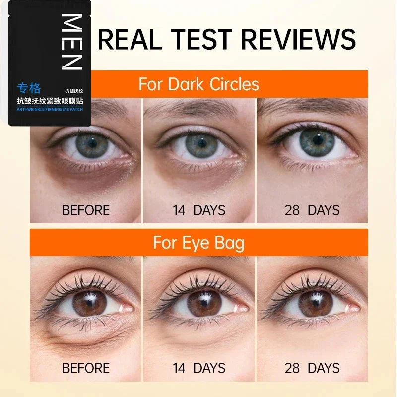 RadiantEyes™ - Eye Bags Removal Patch