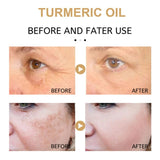 AntiAging ™ - Turmeric Dark Spot Corrector Serum - TumTum