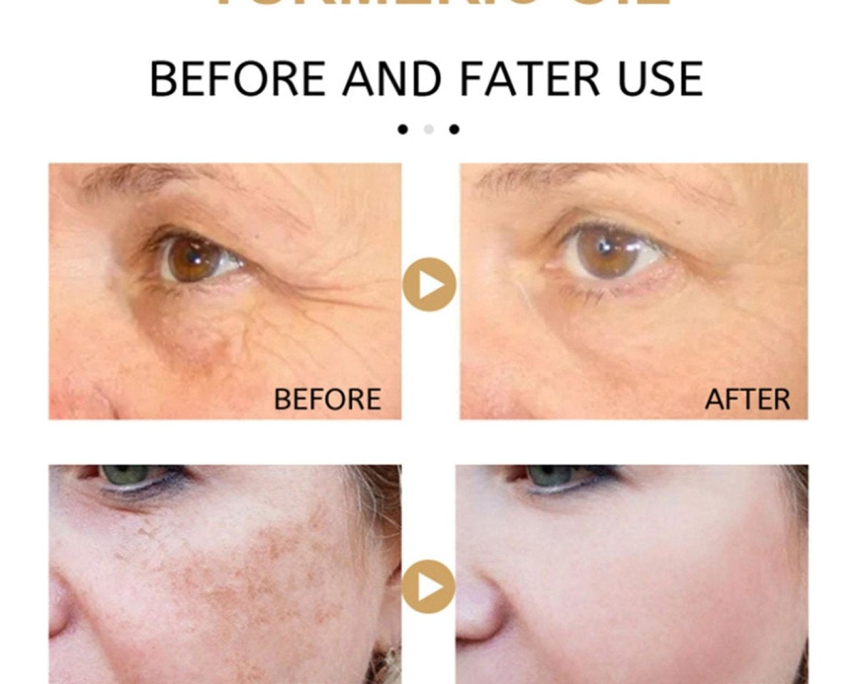 AntiAging ™ - Turmeric Dark Spot Corrector Serum - TumTum