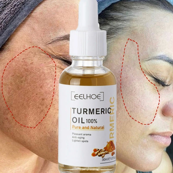 AntiAging ™ - Turmeric Dark Spot Corrector Serum - TumTum