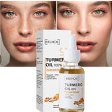 AntiAging ™ - Turmeric Dark Spot Corrector Serum - TumTum