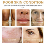 AntiAging ™ - Turmeric Dark Spot Corrector Serum - TumTum