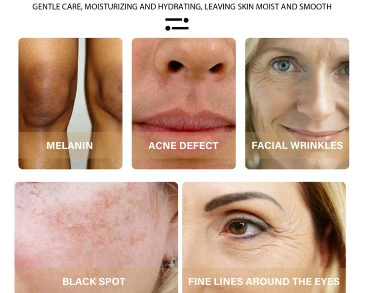AntiAging ™ - Turmeric Dark Spot Corrector Serum - TumTum