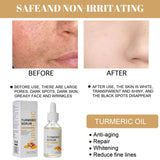 AntiAging ™ - Turmeric Dark Spot Corrector Serum - TumTum