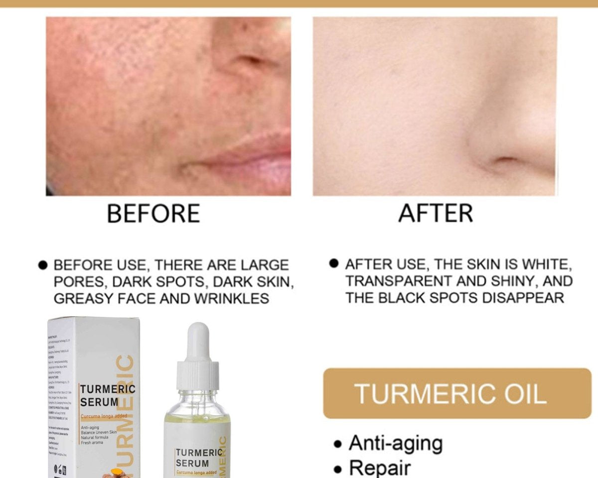 AntiAging ™ - Turmeric Dark Spot Corrector Serum - TumTum