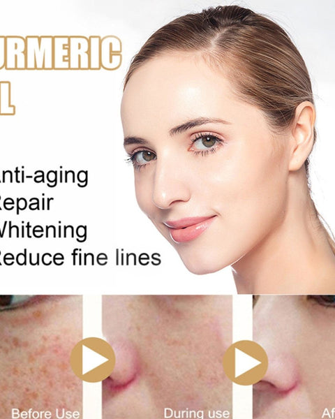 AntiAging ™ - Turmeric Dark Spot Corrector Serum - TumTum