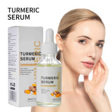 AntiAging ™ - Turmeric Dark Spot Corrector Serum - TumTum