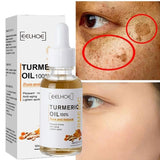 AntiAging ™ - Turmeric Dark Spot Corrector Serum - TumTum
