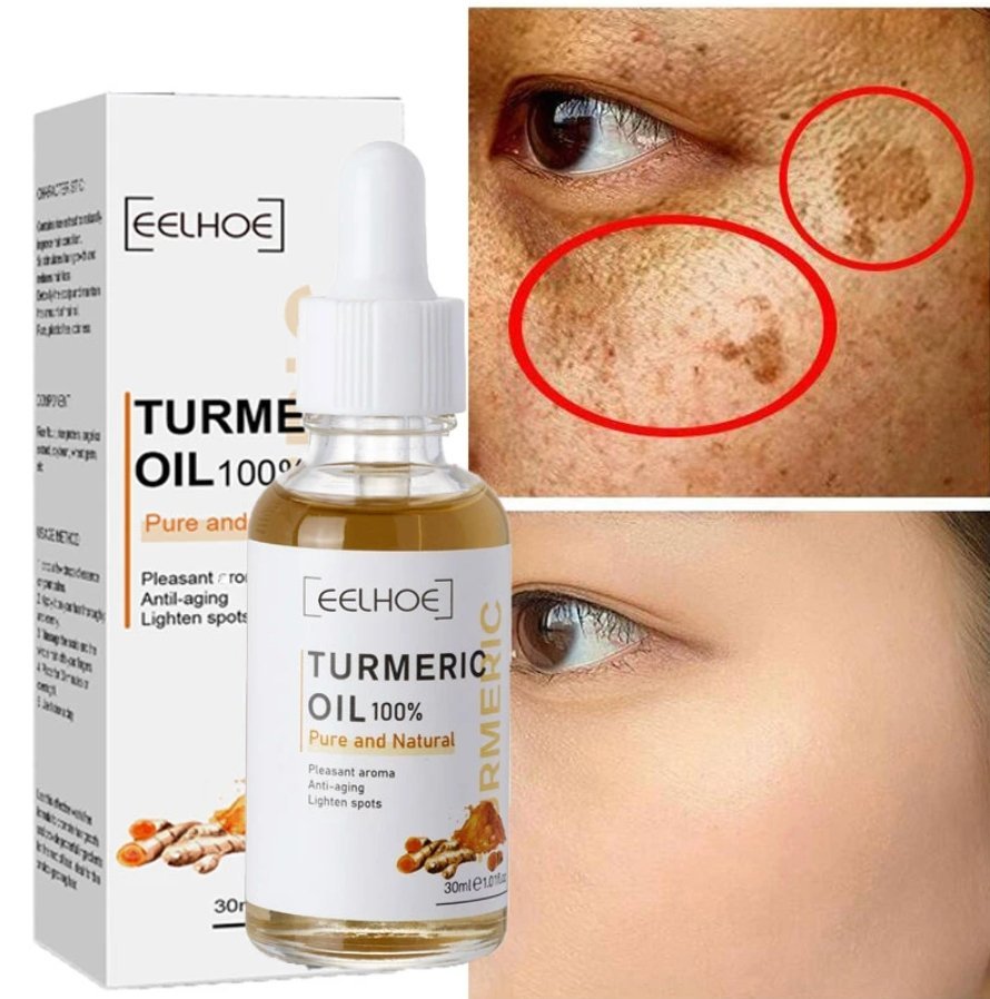 AntiAging ™ - Turmeric Dark Spot Corrector Serum - TumTum