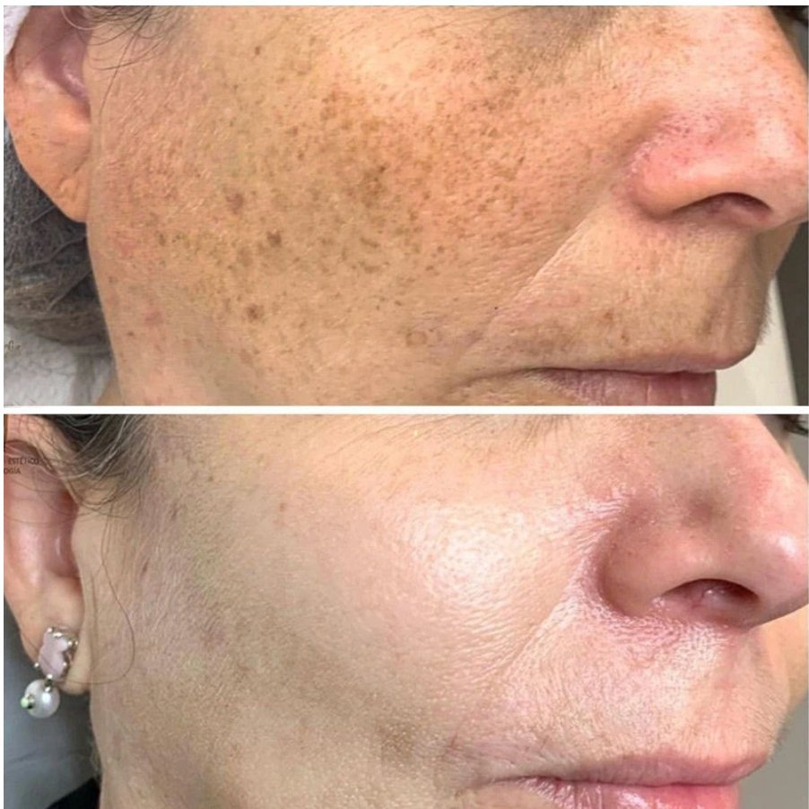 AntiAging ™ - Turmeric Dark Spot Corrector Serum - TumTum