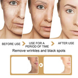 AntiAging ™ - Turmeric Dark Spot Corrector Serum - TumTum