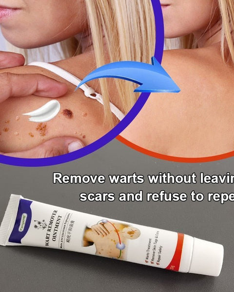 AntiWart™ - Painless Warts Solution - TumTum