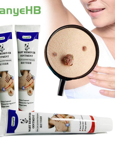 AntiWart™ - Painless Warts Solution - TumTum