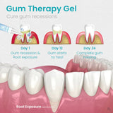 Ceoerty™ Gum Shield Therapy Gel - TumTum