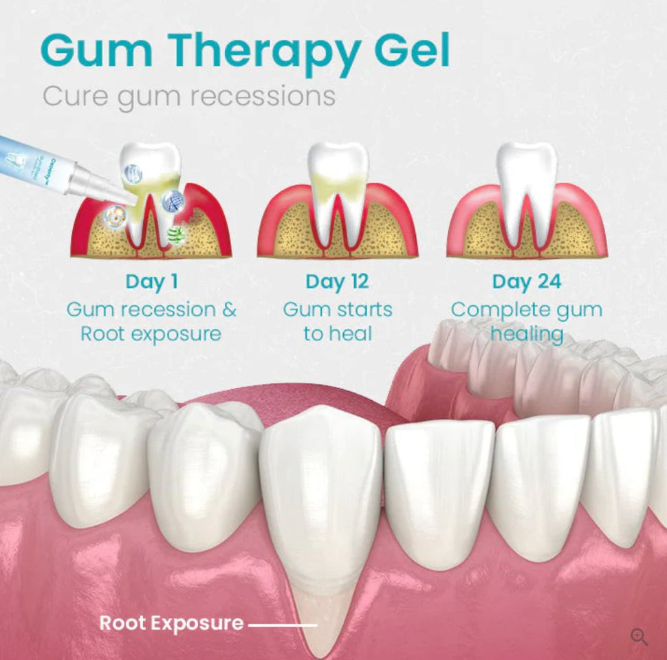 Ceoerty™ Gum Shield Therapy Gel - TumTum