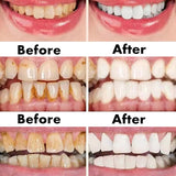 Ceoerty™ Gum Shield Therapy Gel - TumTum