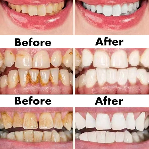 Ceoerty™ Gum Shield Therapy Gel - TumTum