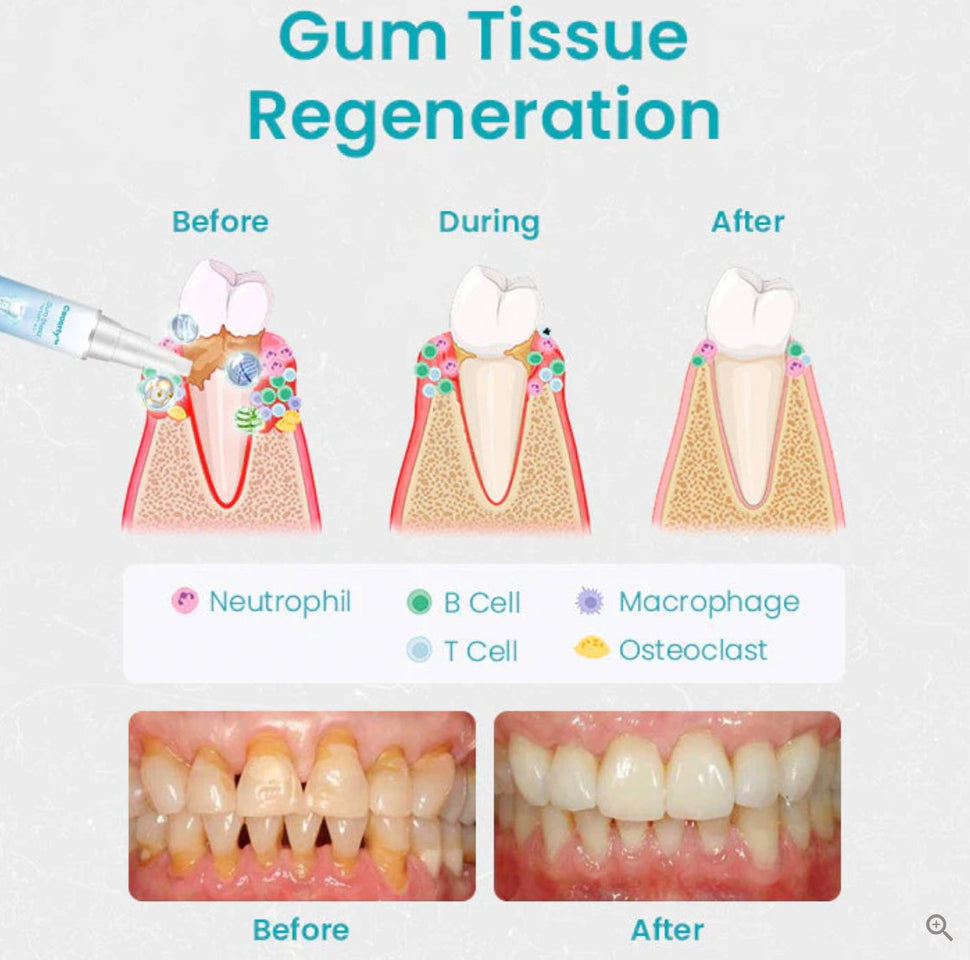 Ceoerty™ Gum Shield Therapy Gel - TumTum