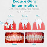 Ceoerty™ Gum Shield Therapy Gel - TumTum